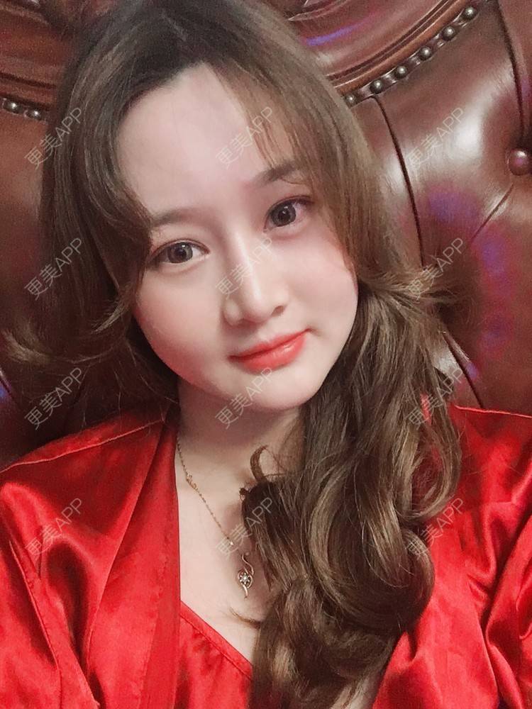 更美 - 小幸福快乐的经验 | 更美研究所 | 自体脂肪丰面颊 | 杭州 | 视频日记