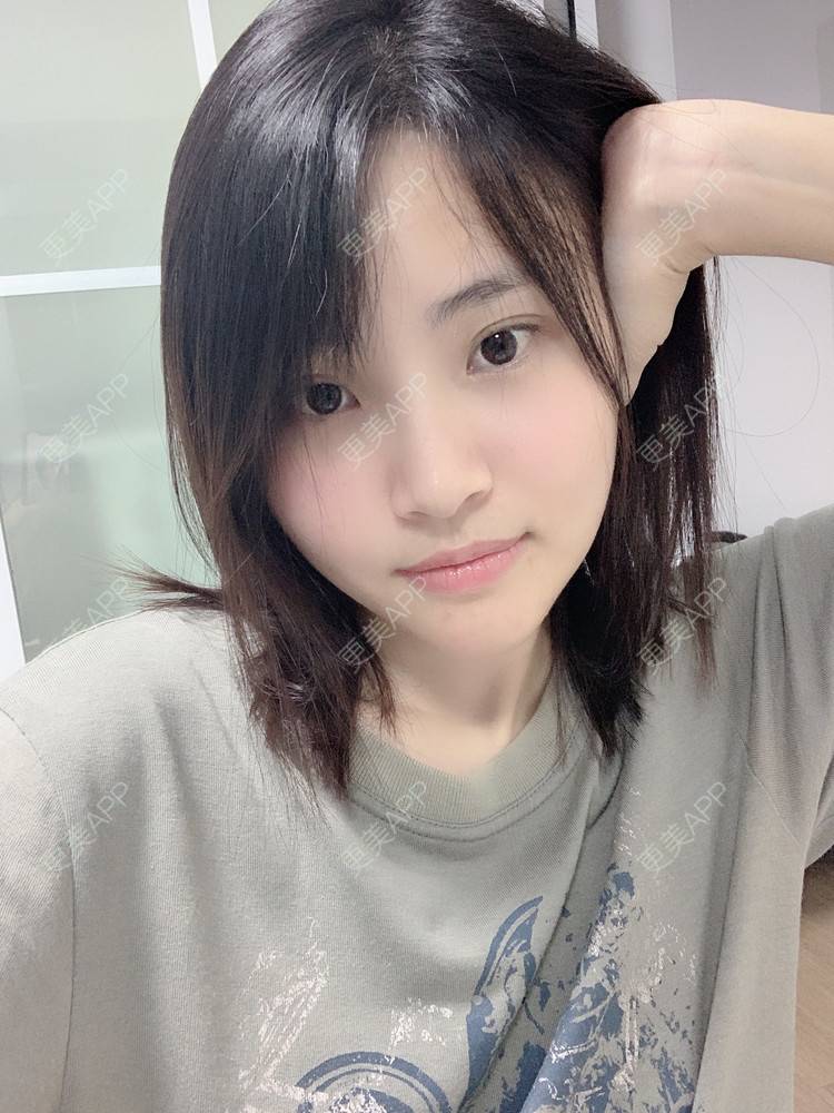 更美 - 大美人图的硅胶垫下巴经验 | 更美研究所 | 硅胶垫下巴 | 杭州