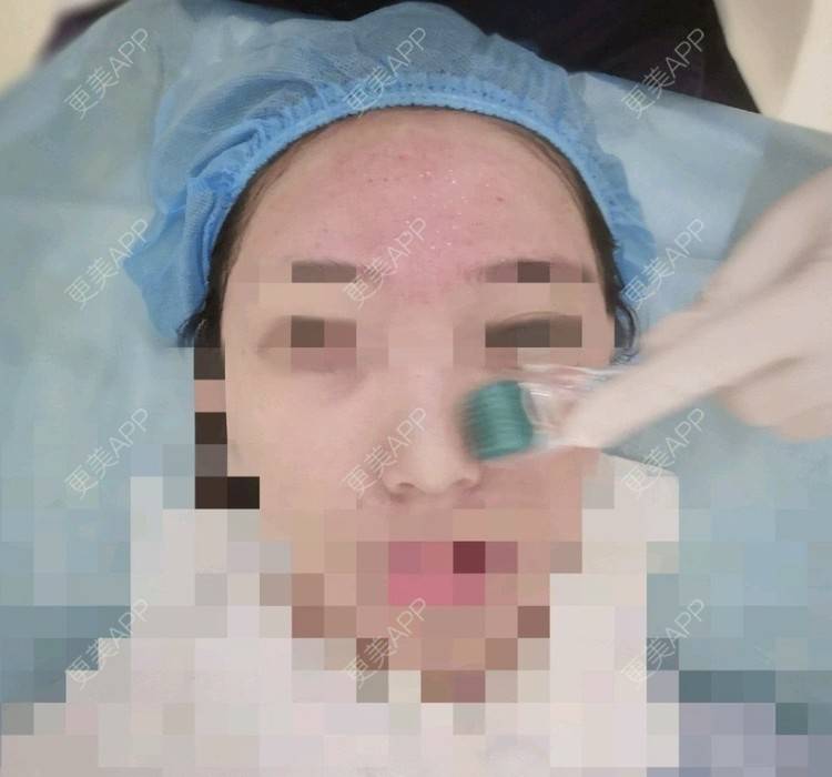 更美 - 更美用户yoCQWeZImL的经验