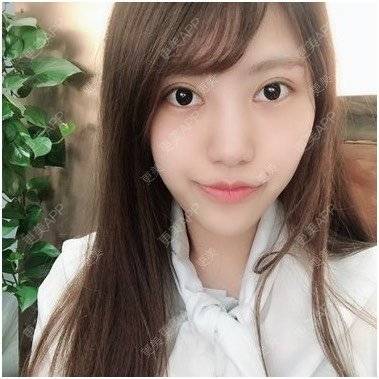 更美 - 乄沉默的感情馅的冷光美白经验 | 隐形牙齿矫正 | 冷光美白 | 种植牙齿 | 台州