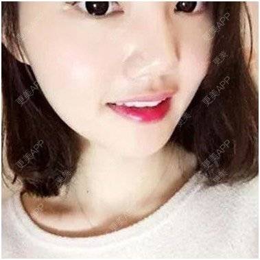 更美 - 誓他为命^谫的错颌锁颌经验 | 错颌锁颌 | 冷光美白 | 合金烤瓷牙 | 台州
