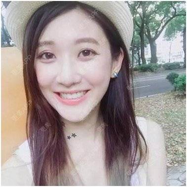 更美 - 失去你我心痛*恫的错颌锁颌经验 | 隐形牙齿矫正 | 错颌锁颌 | 冷光美白 | 合金烤瓷牙 | 台州