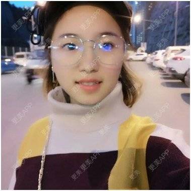 更美 - 要走↙我不挽留沉的错颌锁颌经验 | 隐形牙齿矫正 | 冷光美白 | 错颌锁颌 | 合金烤瓷牙 | 台州