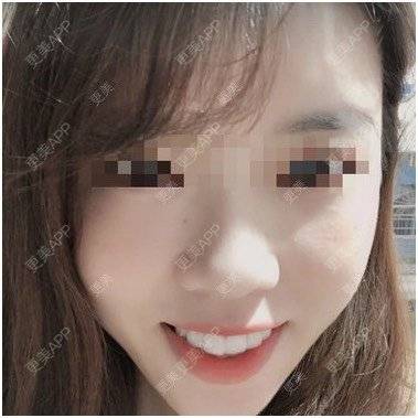 更美 - 乜许、伱卟懂疾的错颌锁颌经验 | 隐形牙齿矫正 | 错颌锁颌 | 冷光美白 | 牙齿瓷贴面 | 台州