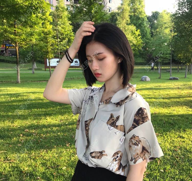 更美 - 罗兰儿的牙齿瓷贴面经验 | 成都 | 牙齿瓷贴面