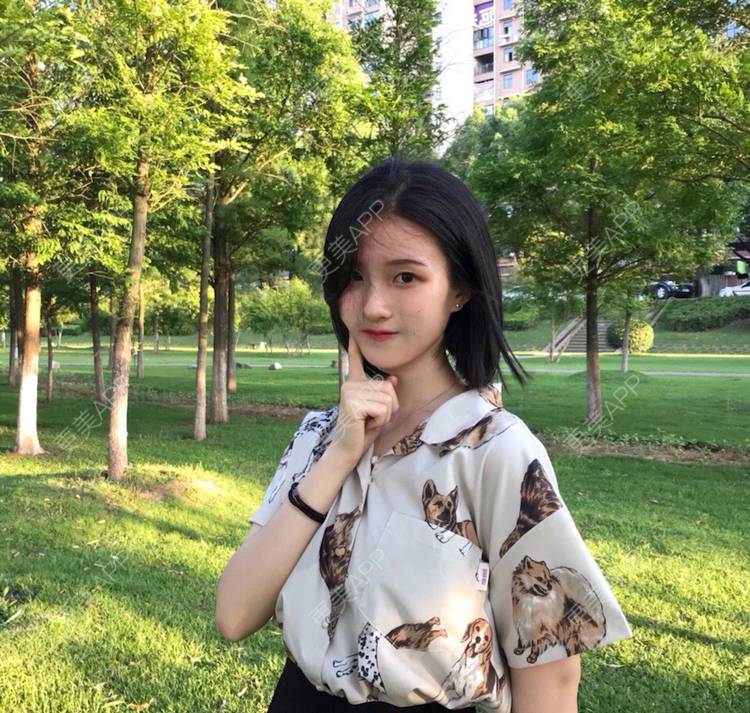 更美 - 罗兰儿的牙齿瓷贴面经验 | 成都 | 牙齿瓷贴面