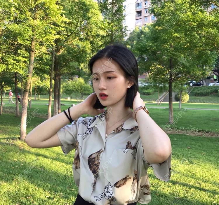 更美 - 罗兰儿的牙齿瓷贴面经验 | 成都 | 牙齿瓷贴面