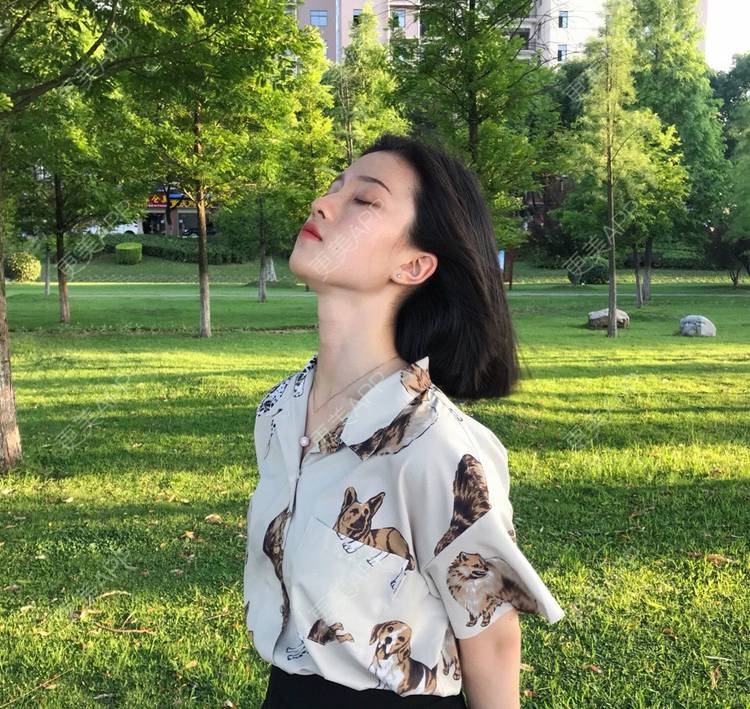 更美 - 罗兰儿的牙齿瓷贴面经验 | 成都 | 牙齿瓷贴面