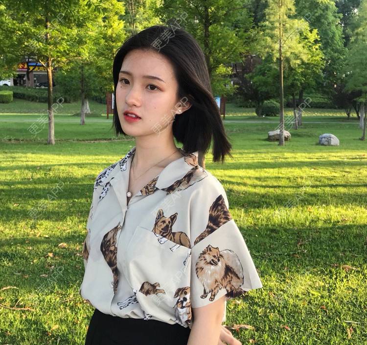 更美 - 罗兰儿的牙齿瓷贴面经验 | 成都 | 牙齿瓷贴面