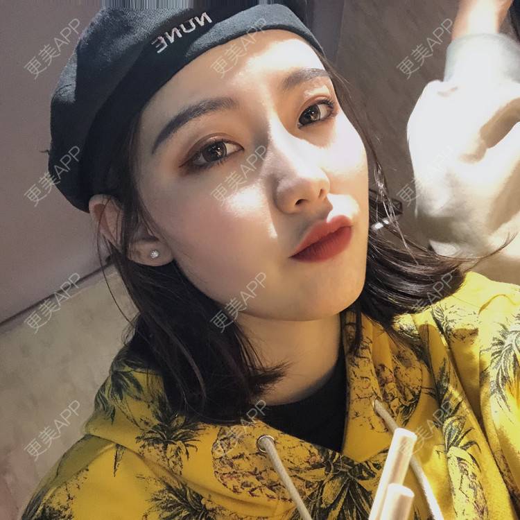更美 - 四川悦好医学美容医院的吸脂瘦脸经验 | 吸脂瘦脸
