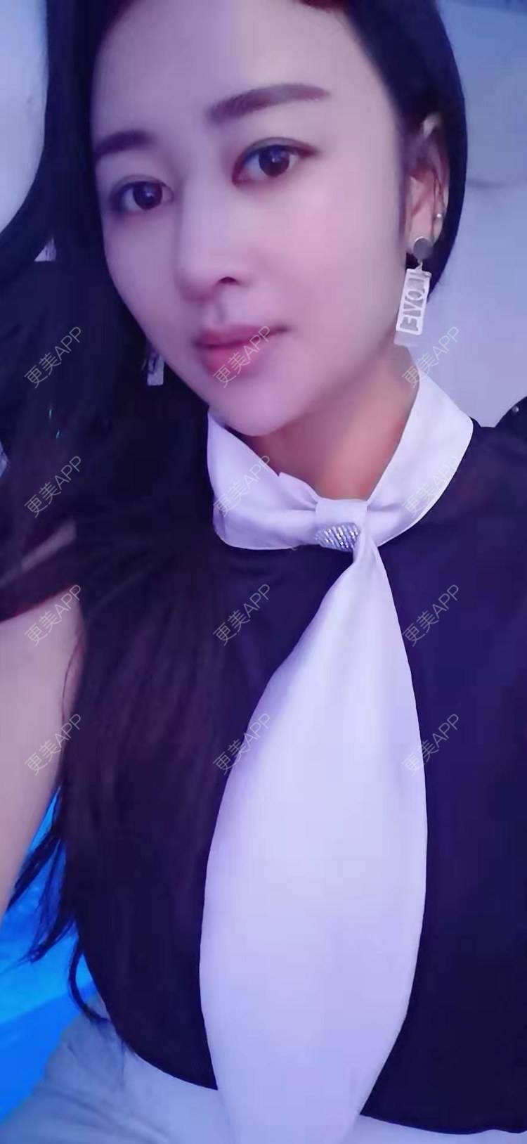 更美 - 白落落的隆鼻经验 | 台州 | 隆鼻