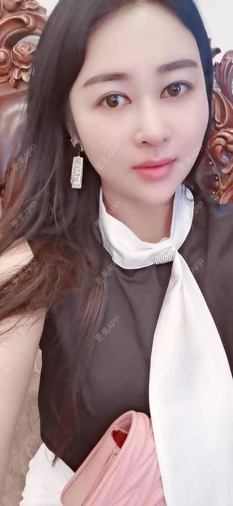 更美 - 白落落的隆鼻经验 | 台州 | 隆鼻