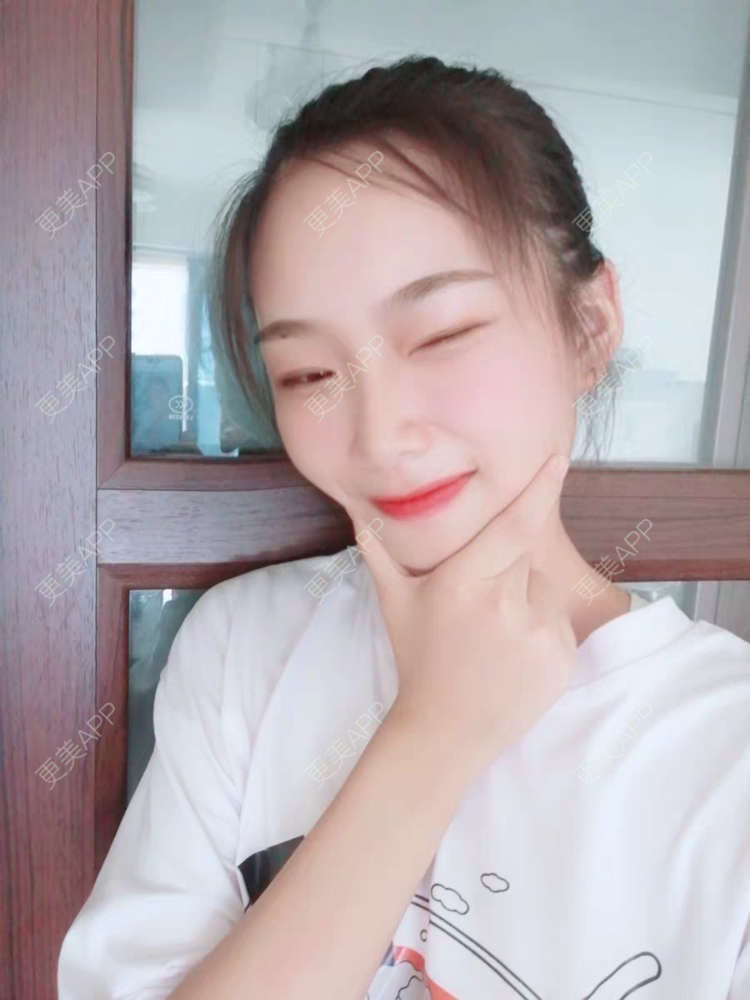 更美 - 遗忘那情的脱唇毛经验 | 脱唇毛 | 上海 | 激光脱腋毛