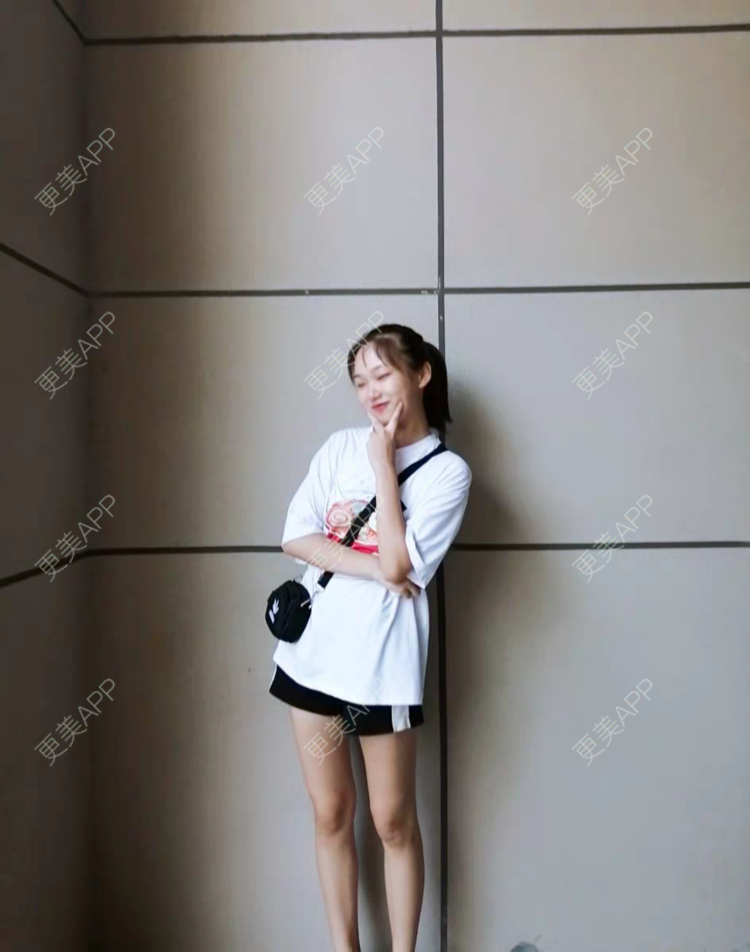 更美 - 遗忘那情的脱唇毛经验 | 脱唇毛 | 上海 | 激光脱腋毛