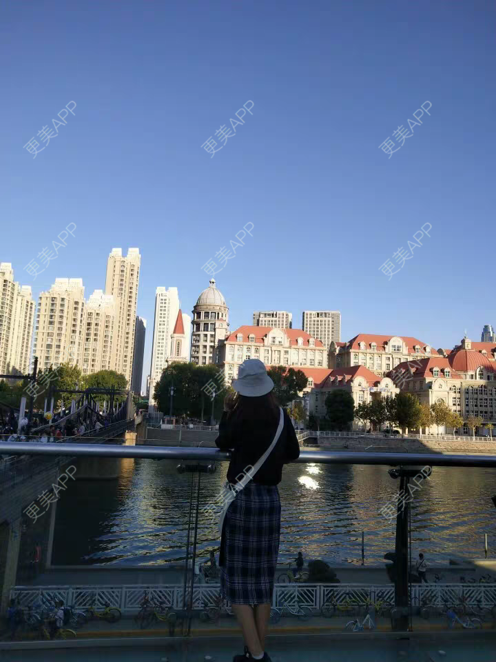 更美 - 遗忘那情的脱唇毛经验 | 脱唇毛 | 上海 | 激光脱腋毛