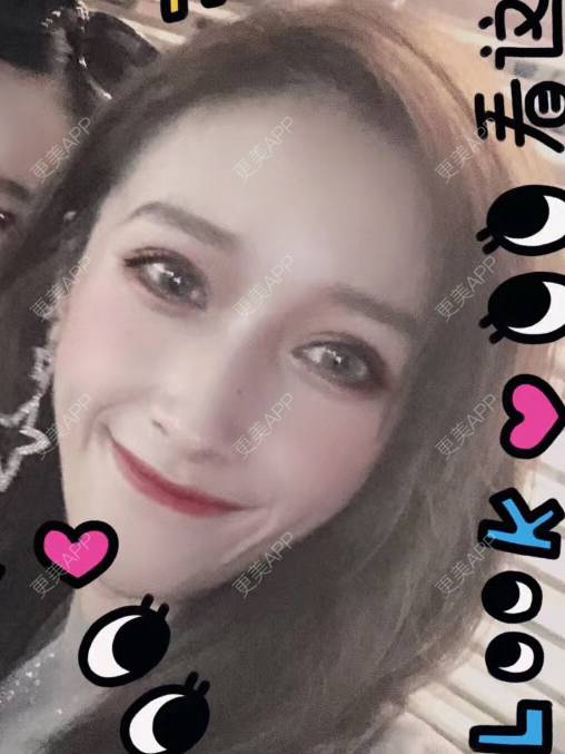 更美 - 丢了灵魂的孩纸的唇腭裂修复经验 | 厚唇改薄 | 唇腭裂修复 | 玻尿酸唇部 | 自体脂肪丰唇 | 胶原蛋白丰唇