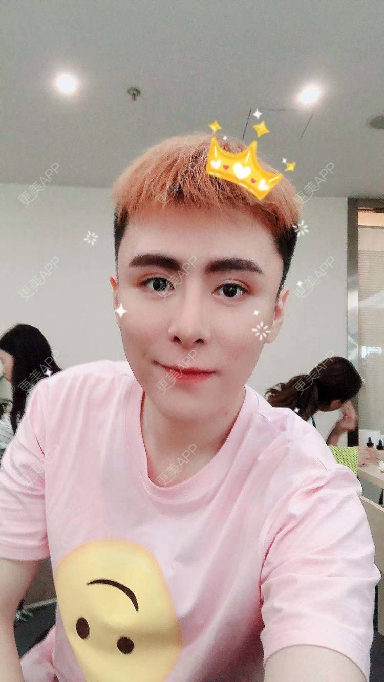 更美 - 陈温柔~的膨体垫眉弓经验 | 膨体垫眉弓 | 视频日记 | 重庆