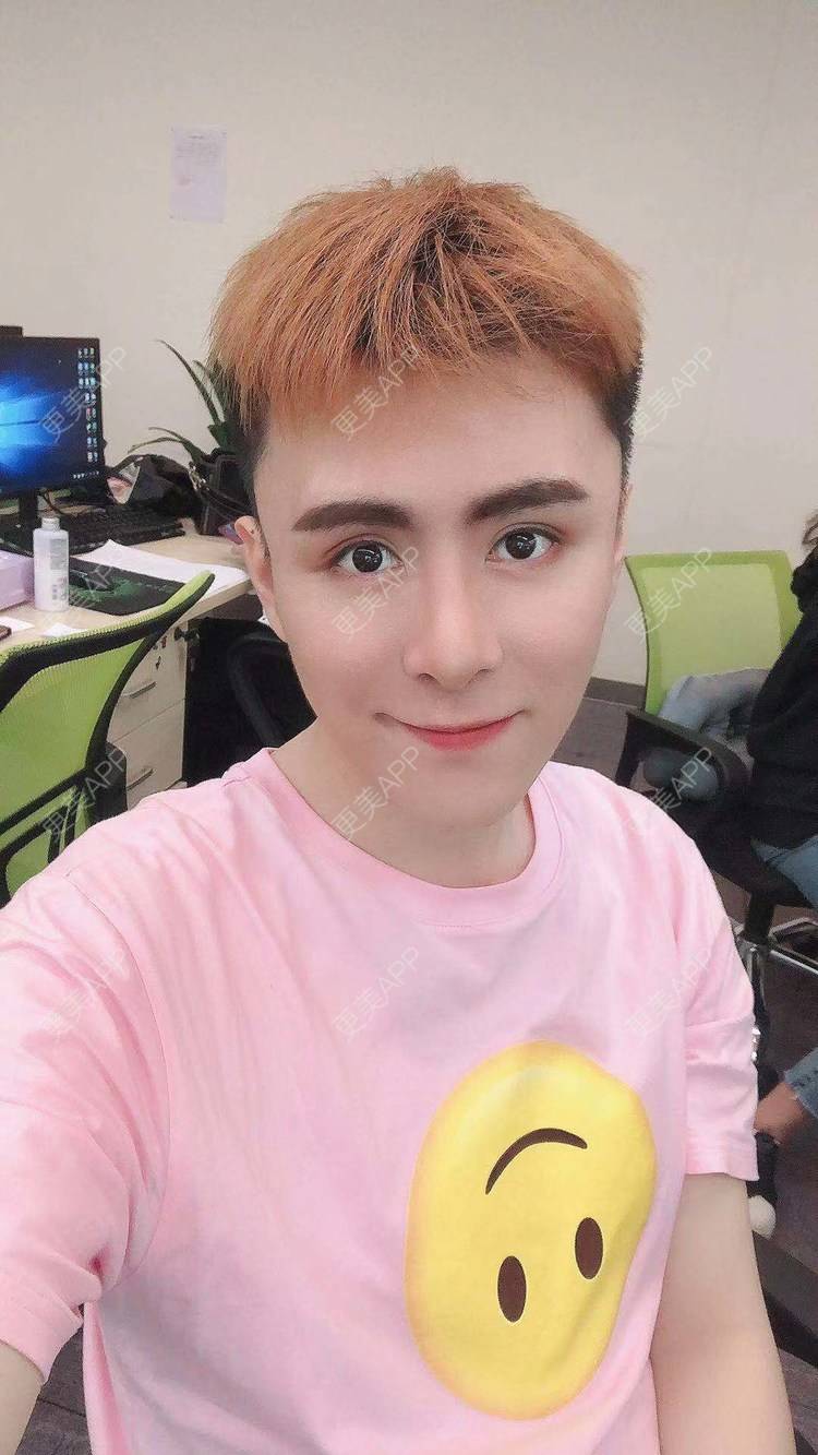 更美 - 陈温柔~的膨体垫眉弓经验 | 膨体垫眉弓 | 视频日记 | 重庆