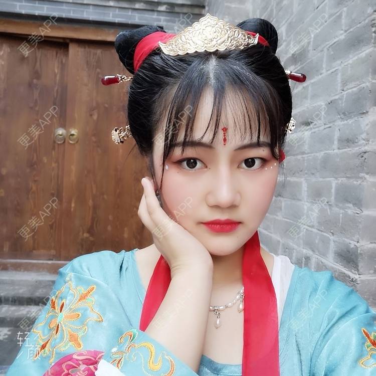 更美 - 花花cd的隆鼻经验 | 郑州 | 鼻部多项 | 隆鼻 | 鼻中隔软骨隆鼻 | 膨体隆鼻 | 鼻孔矫正