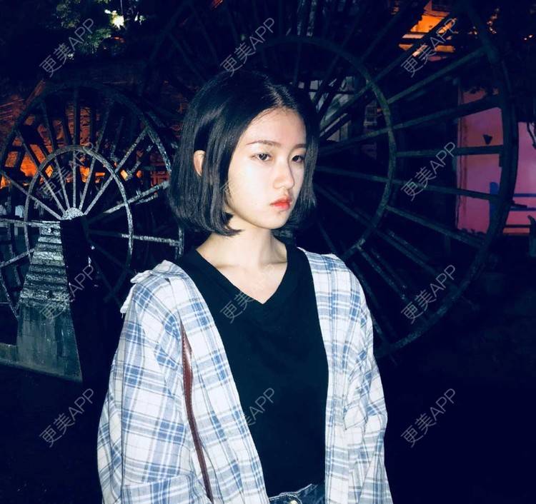 更美 - 罗兰儿的牙齿瓷贴面经验 | 成都 | 牙齿瓷贴面