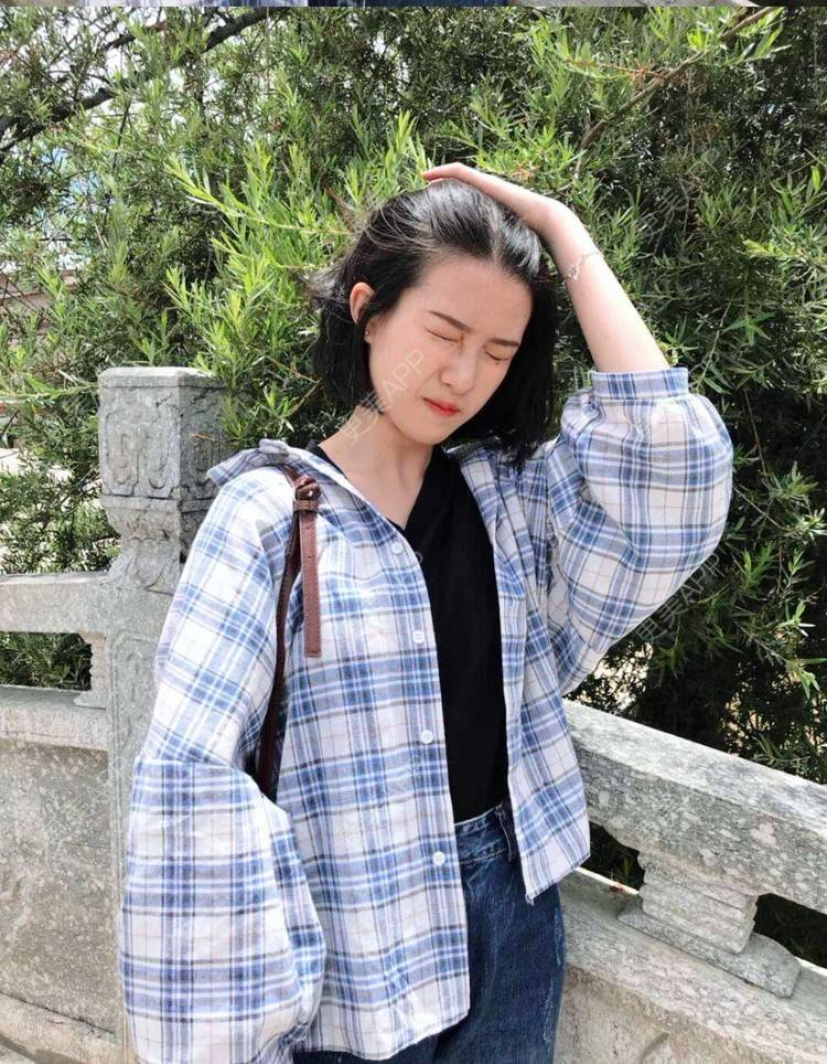 更美 - 罗兰儿的牙齿瓷贴面经验 | 成都 | 牙齿瓷贴面