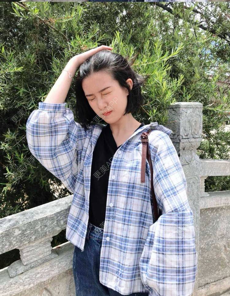 更美 - 罗兰儿的牙齿瓷贴面经验 | 成都 | 牙齿瓷贴面