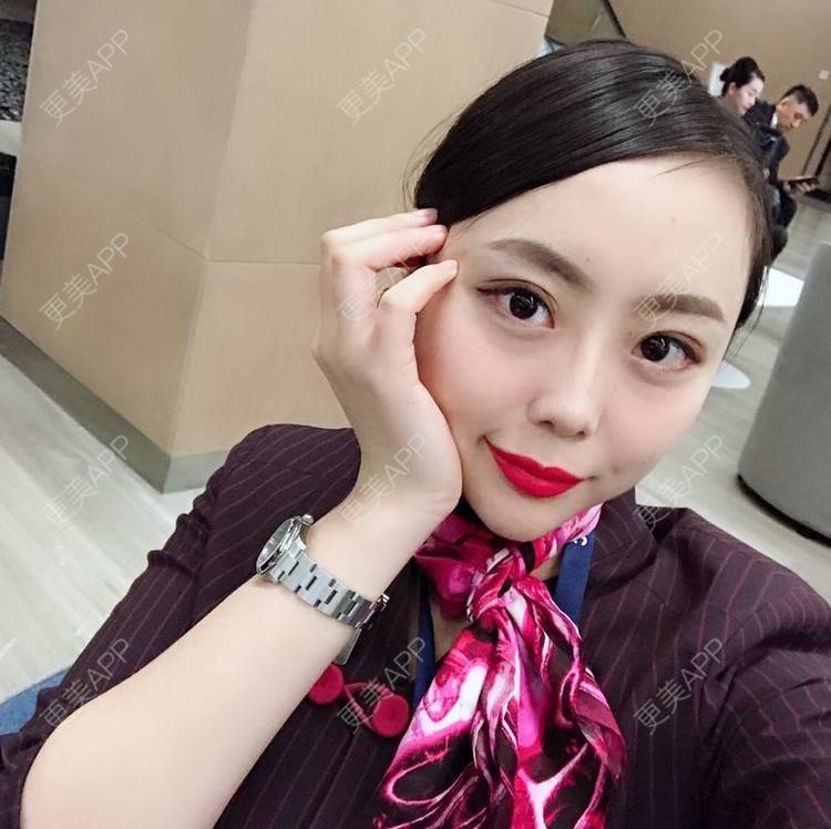 更美 - 更美用户QhDs9RVr2A的玻尿酸面部细纹经验 | 上海 | 玻尿酸面部细纹