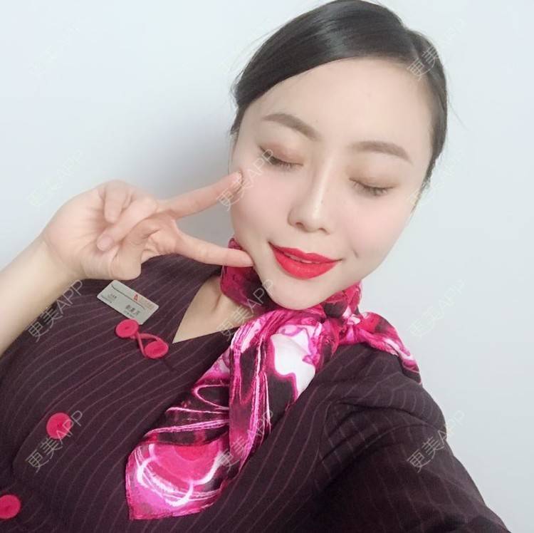 更美 - 更美用户QhDs9RVr2A的玻尿酸面部细纹经验 | 上海 | 玻尿酸面部细纹