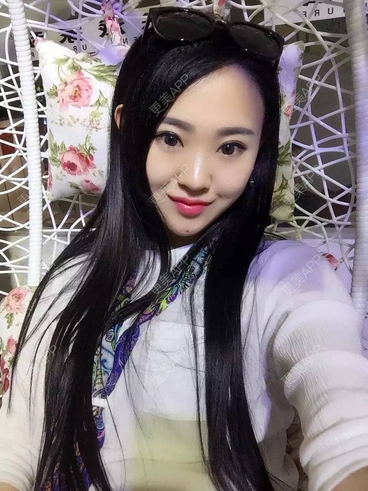 更美 - 不化妆才是真美妞胀的硅胶隆鼻经验 | 硅胶隆鼻 | 南京