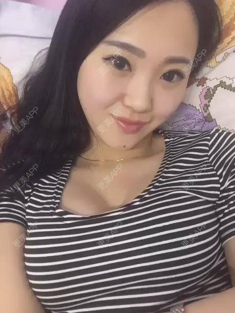 更美 - 不化妆才是真美妞胀的硅胶隆鼻经验 | 硅胶隆鼻 | 南京