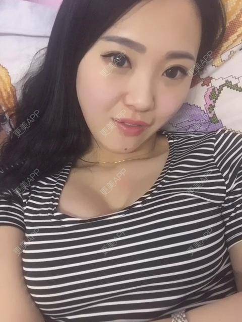 更美 - 不化妆才是真美妞胀的硅胶隆鼻经验 | 硅胶隆鼻 | 南京