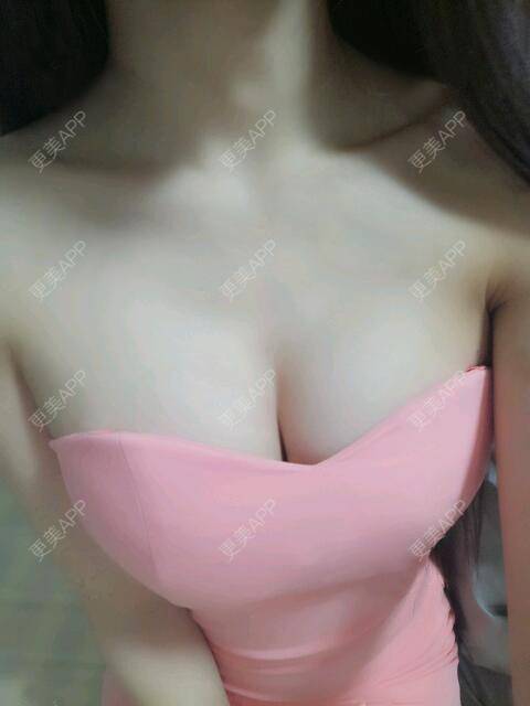 更美 - 更美用户2o60cQKUEs的假体隆胸经验 | 假体隆胸 | 乳头再造 | 美胸套餐 | 重庆