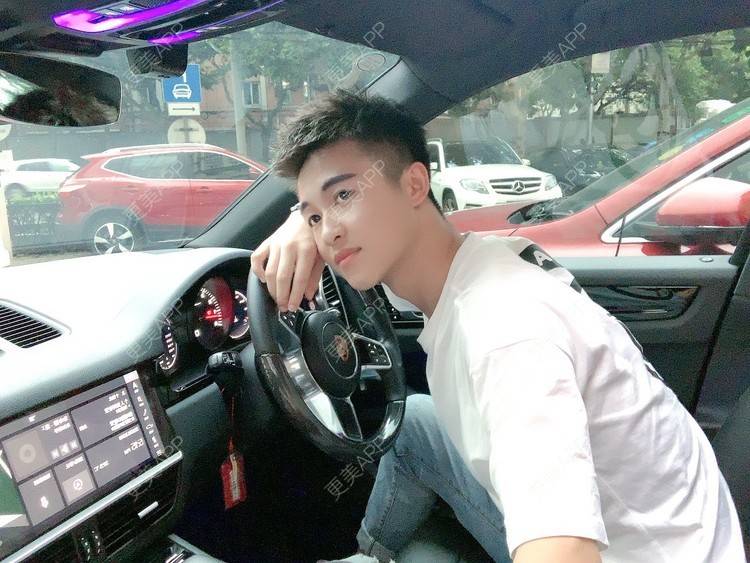 更美 - 雷凯🤳🏻的颧骨内推经验 | V脸套餐 | 颧骨内推 | 上海 | 颧骨提高 | 面部不对称矫正 | 颧弓降低 | 全脸整形套餐 | 下颌角切除