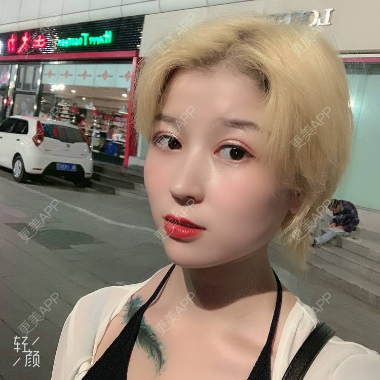 更美 - 徐金玉 医生的全切双眼皮经验 | 全切双眼皮