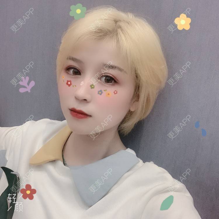 更美 - 徐金玉 医生的全切双眼皮经验 | 全切双眼皮