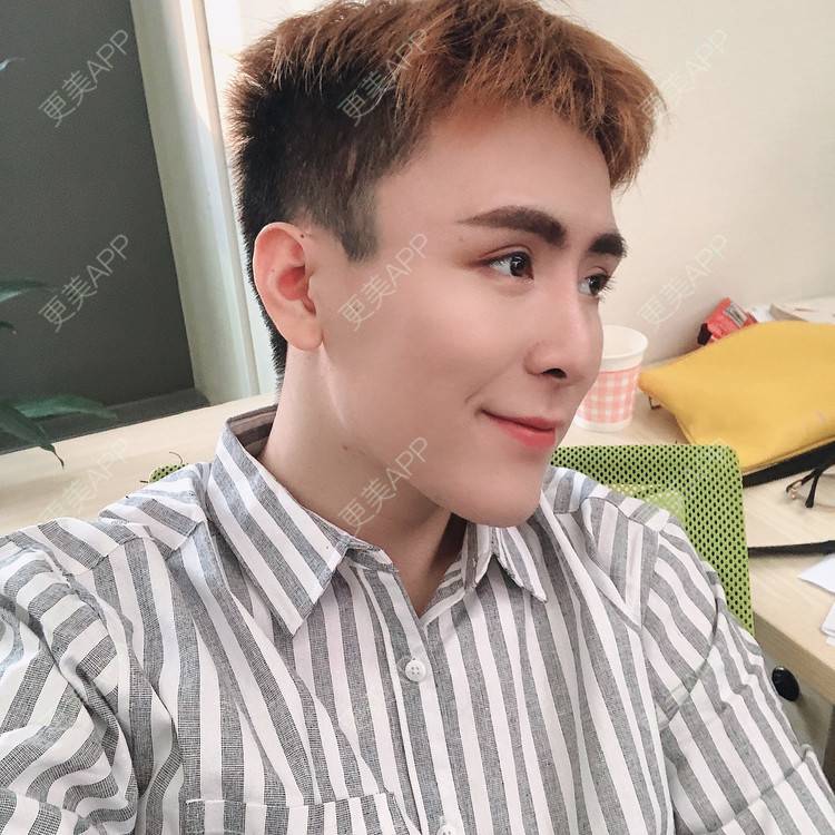 更美 - 陈温柔~的膨体垫眉弓经验 | 膨体垫眉弓 | 视频日记 | 重庆