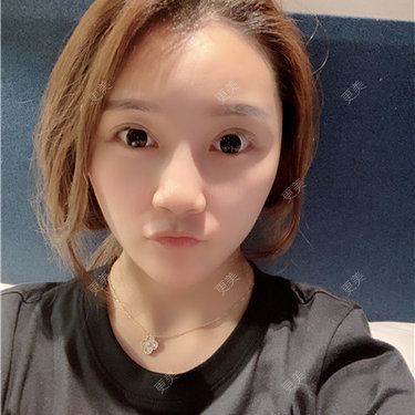 更美用户R9I1eBnQlu