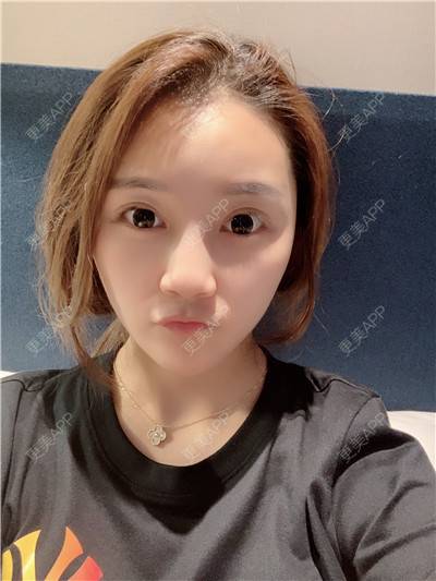 更美 - 更美用户R9I1eBnQlu的胶原蛋白淡化黑眼圈经验 | 视频日记 | 胶原蛋白淡化黑眼圈