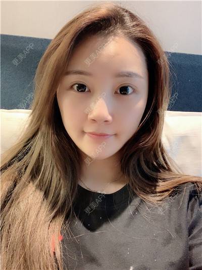 更美 - 更美用户R9I1eBnQlu的胶原蛋白淡化黑眼圈经验 | 视频日记 | 胶原蛋白淡化黑眼圈