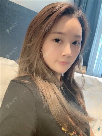 更美 - 更美用户R9I1eBnQlu的胶原蛋白淡化黑眼圈经验 | 视频日记 | 胶原蛋白淡化黑眼圈