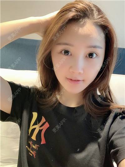更美 - 更美用户R9I1eBnQlu的胶原蛋白淡化黑眼圈经验 | 视频日记 | 胶原蛋白淡化黑眼圈