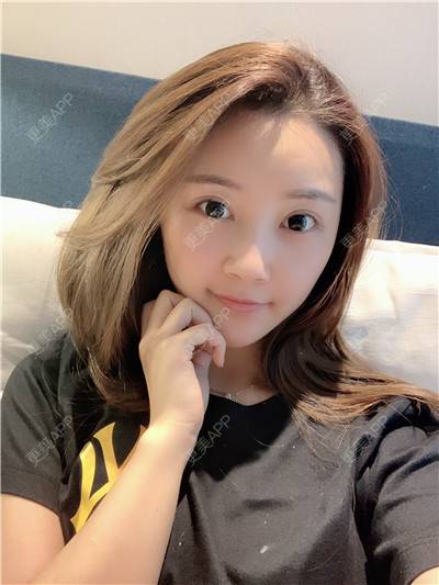 更美 - 更美用户R9I1eBnQlu的胶原蛋白淡化黑眼圈经验 | 视频日记 | 胶原蛋白淡化黑眼圈