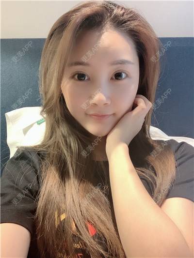 更美 - 更美用户R9I1eBnQlu的胶原蛋白淡化黑眼圈经验 | 视频日记 | 胶原蛋白淡化黑眼圈