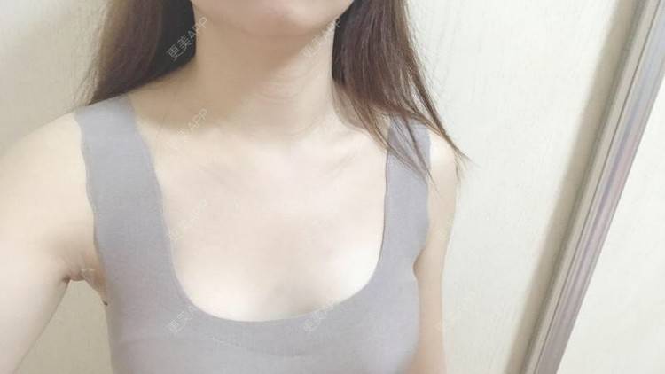 更美 - 吢臟被挖悾の痛陆的丰胸（隆胸）经验 | 假体隆胸 | 自体脂肪隆胸 | 隆胸手术修复 | 乳房再造 | 胸部下垂矫正 | 南宁 | 美胸套餐