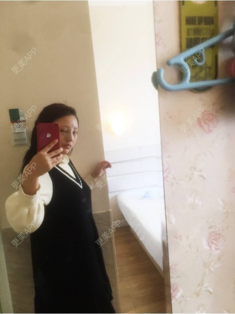 更美 - 更美用户ZSYAfLAIcp的硅胶隆鼻经验 | 耳软骨隆鼻 | 硅胶隆鼻 | 长春