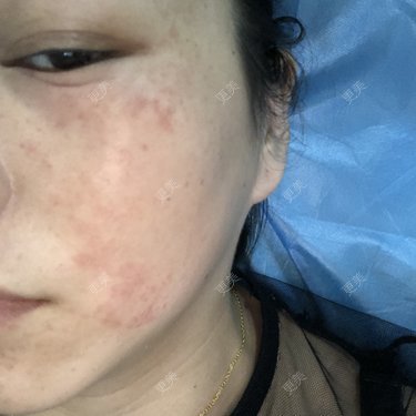 小太阳☀@220