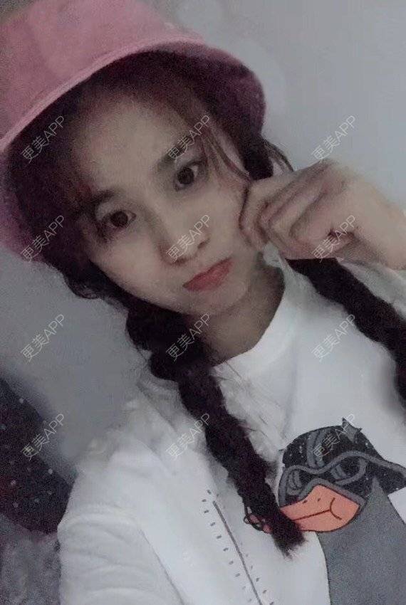 更美 - 宝儿姐😄的全瓷牙经验 | 全瓷牙 | 合金烤瓷牙 | 二氧化锆烤瓷牙