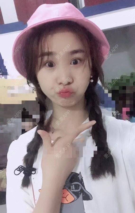 更美 - 宝儿姐😄的全瓷牙经验 | 全瓷牙 | 合金烤瓷牙 | 二氧化锆烤瓷牙