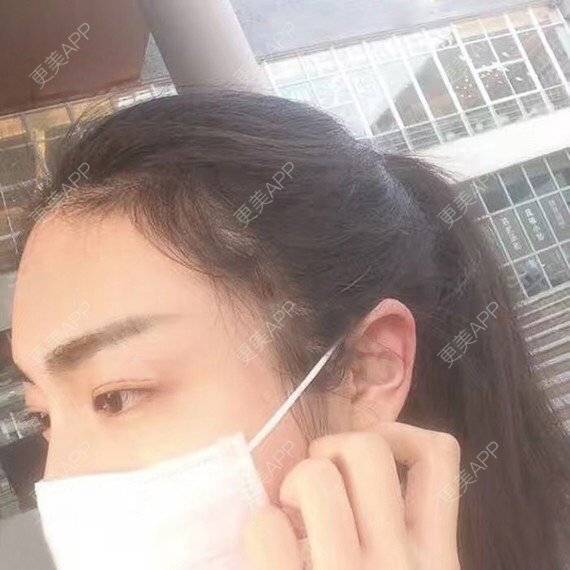 更美 - 宝儿姐😄的全瓷牙经验 | 全瓷牙 | 合金烤瓷牙 | 二氧化锆烤瓷牙
