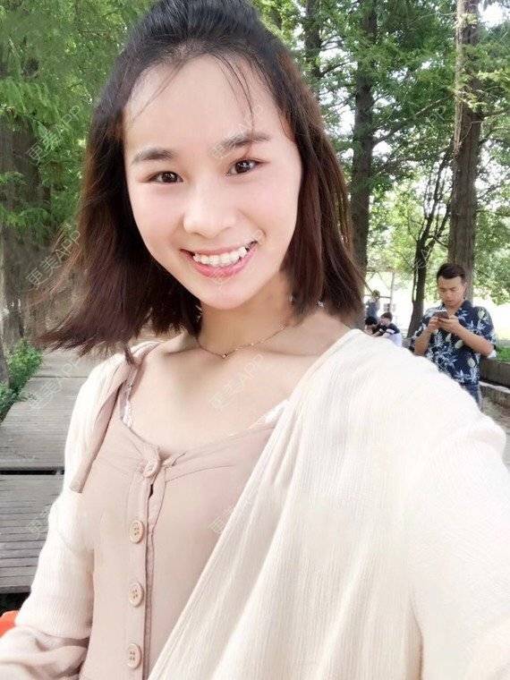 更美 - 宝儿姐😄的全瓷牙经验 | 全瓷牙 | 合金烤瓷牙 | 二氧化锆烤瓷牙